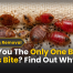 Are You The Only One Bed Bugs Bite? Find Out Why