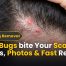 Bed Bugs bite Your Scalp? Signs, Photos & Fast Relief A Complete CT Homeowner’s Guide 8 bed bugs bite your scalp? Signs, Photos & Fast Relief