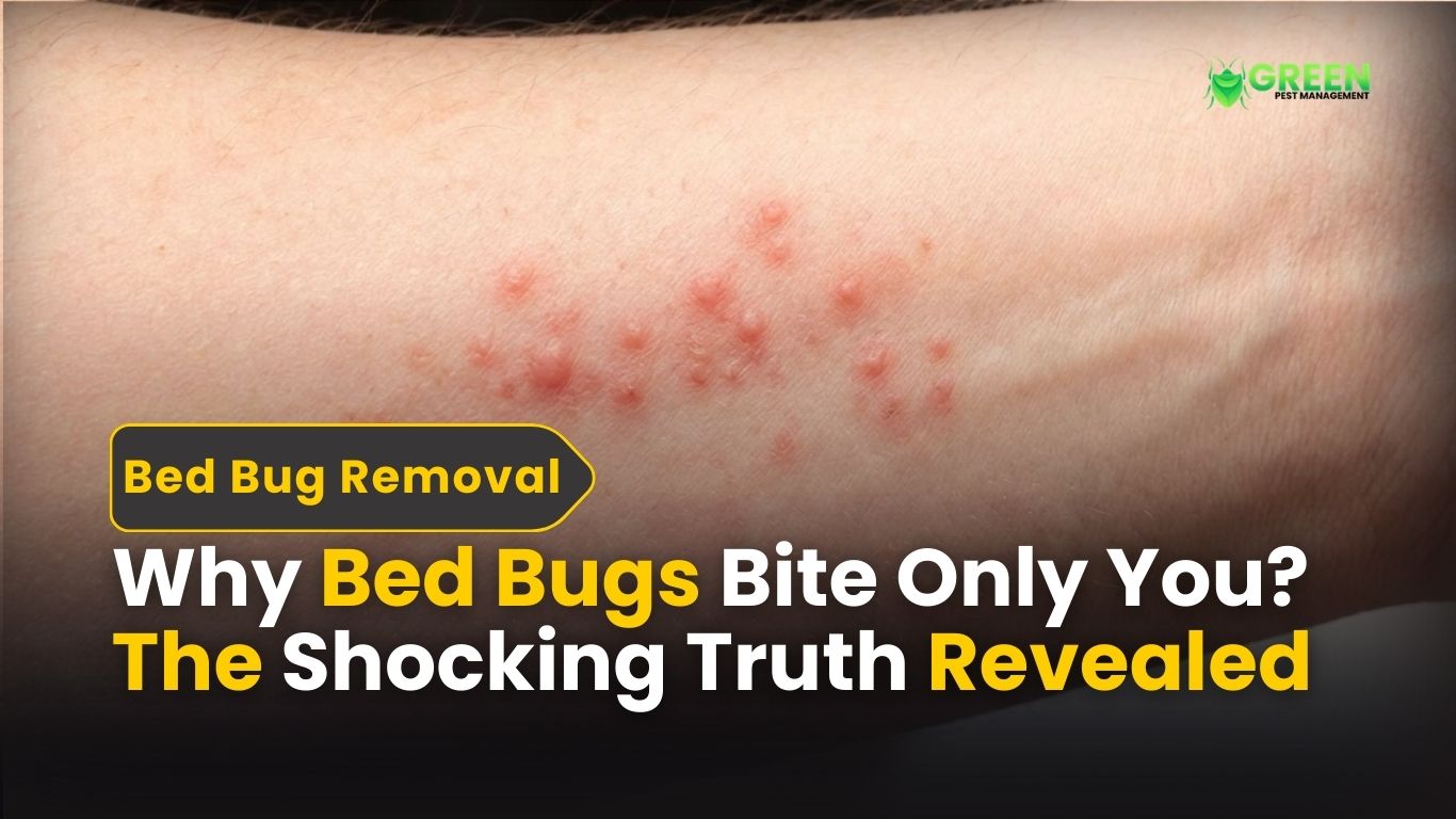 Why Bed Bugs Bite Only You? The Shocking Truth Revealed